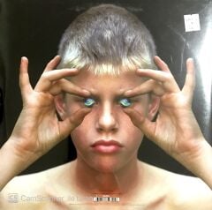 Marillion – Marbles ( 2LP) LP